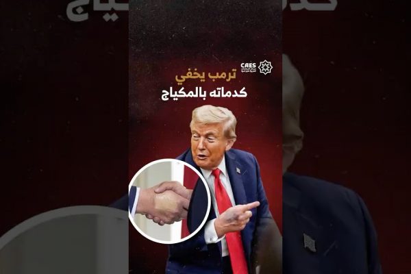 ترمب يخفي كدماته بالمكياج